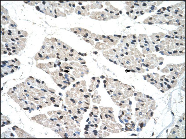 Anti-RALY antibody produced in rabbit