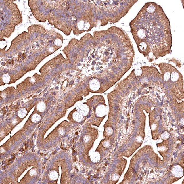 Anti-RASSF1 antibody produced in rabbit