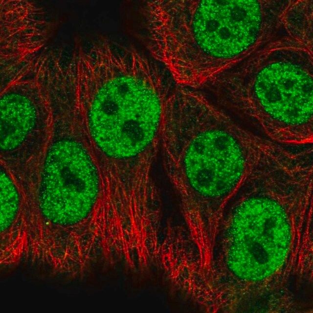 Anti-RBAK antibody produced in rabbit