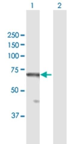 Anti-RBBP5 antibody produced in mouse