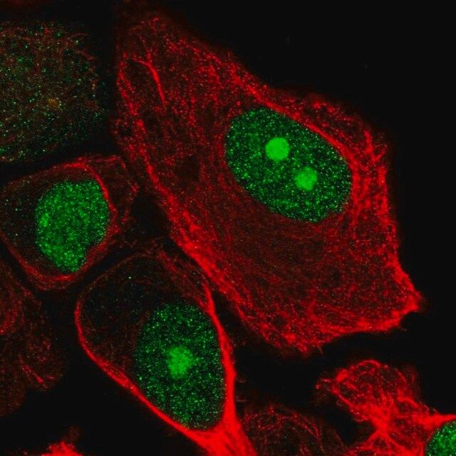 Anti-RBBP5 antibody produced in rabbit