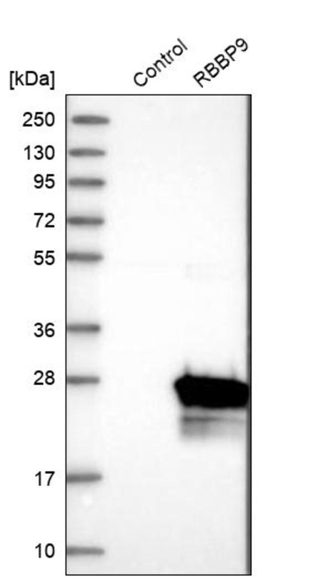 Anti-RBBP9 antibody produced in rabbit