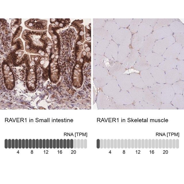 Anti-RAVER1 antibody produced in rabbit