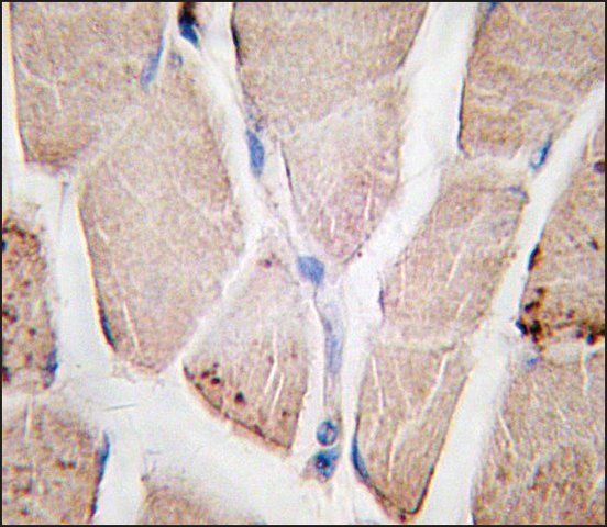 Anti-PYGM (C-term) antibody produced in rabbit