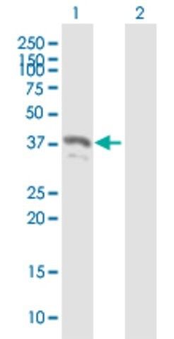 Anti-PYCR2 antibody produced in mouse