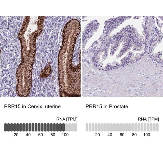 Anti-PRR15 antibody produced in rabbit