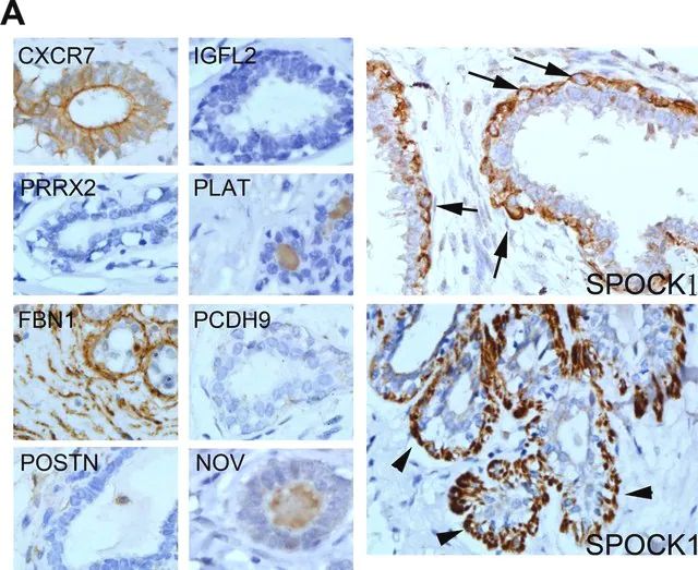 Anti-PRRX2 antibody produced in rabbit