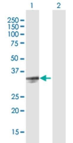 Anti-PRSS21 antibody produced in mouse