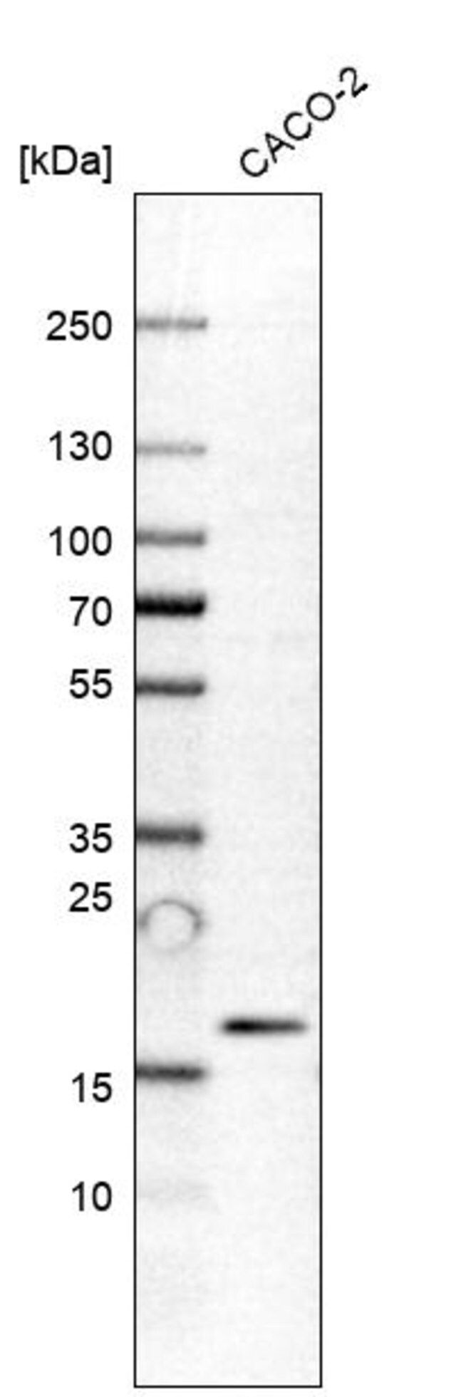 Anti-PRR13 antibody produced in rabbit