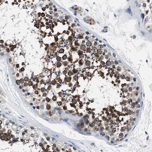 Anti-PRTFDC1 antibody produced in rabbit