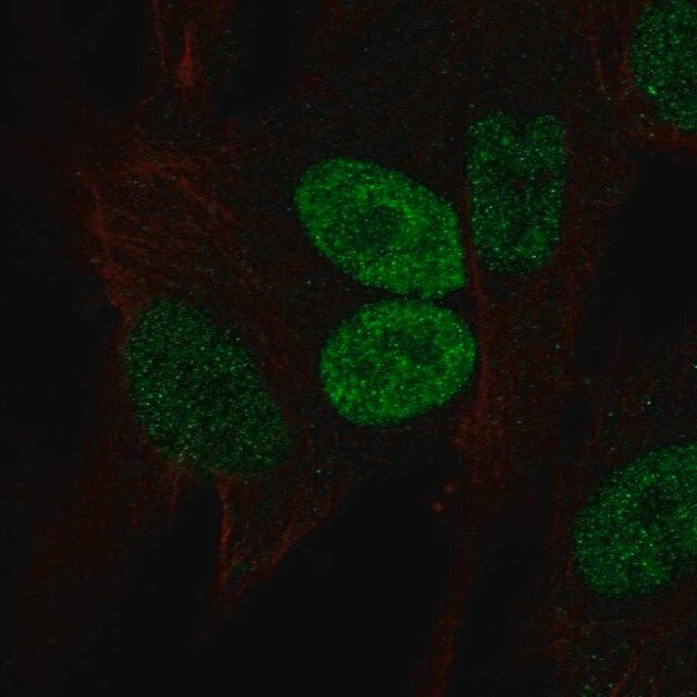 Anti-PRRX2 antibody produced in rabbit