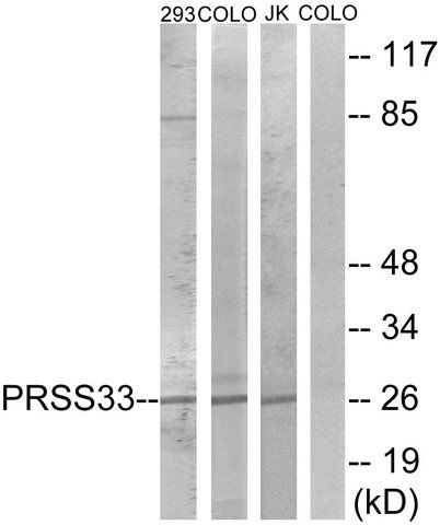 Anti-PRSS33 antibody produced in rabbit