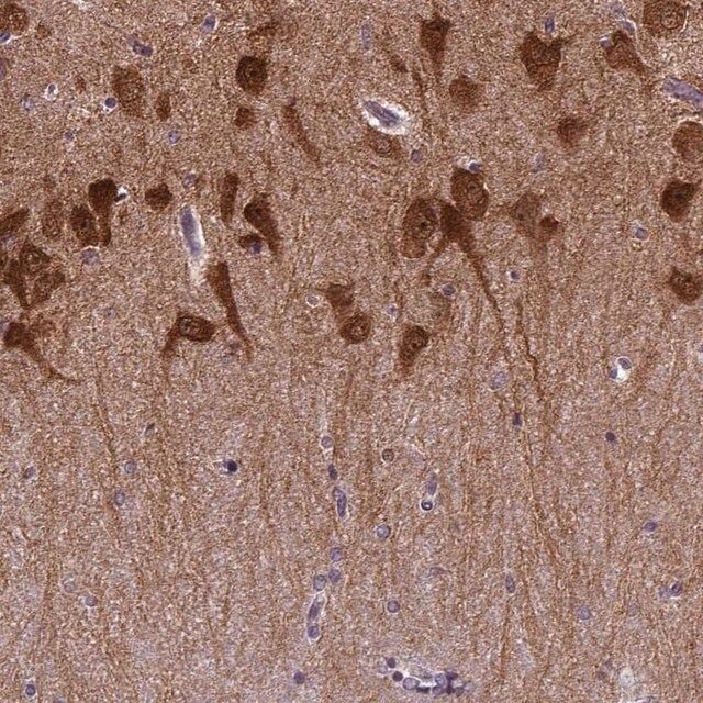 Anti-PRRT1 antibody produced in rabbit