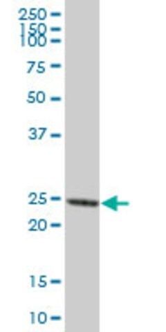 Anti-PRTN3 antibody produced in mouse