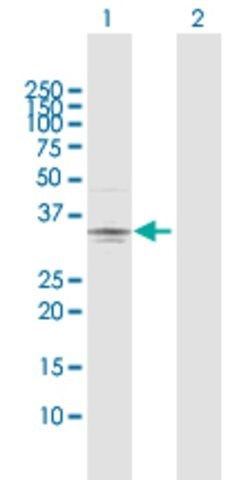 Anti-PRSS21 antibody produced in rabbit