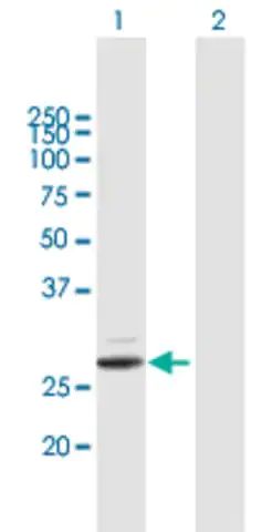 Anti-PRSS2 antibody produced in mouse