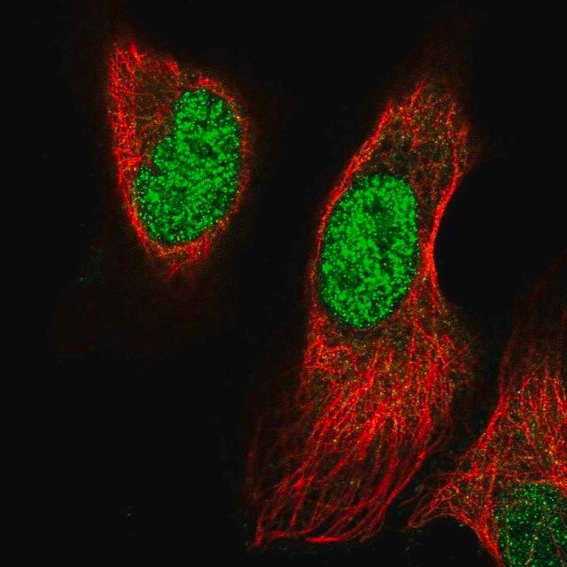 Anti-PRRX1 antibody produced in rabbit