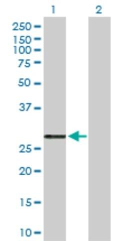 Anti-PRSS2 antibody produced in rabbit