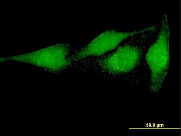 Anti-PRUNE antibody produced in mouse