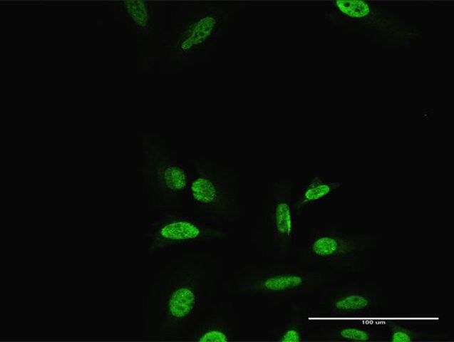 Anti-PRRX2 antibody produced in rabbit