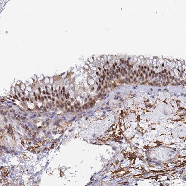 Anti-PRRT4 antibody produced in rabbit