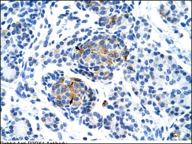 Anti-P2RX1 antibody produced in rabbit