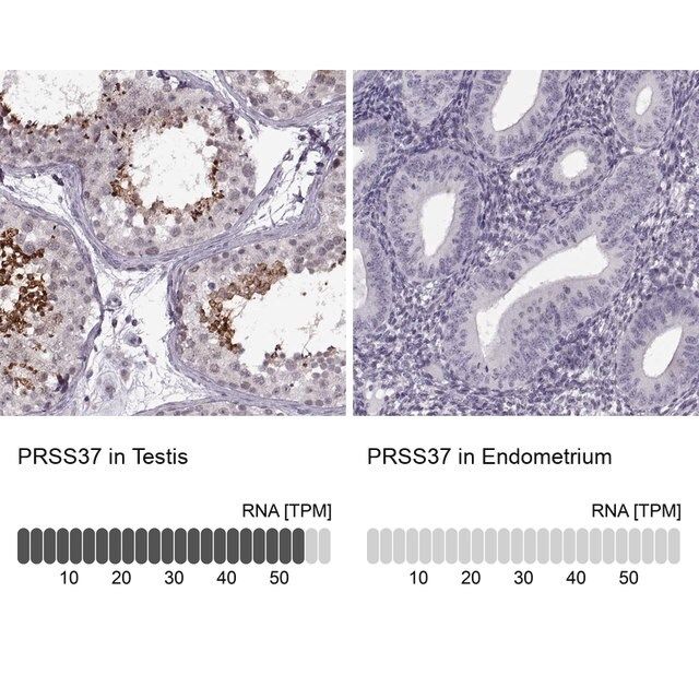 Anti-PRSS37 antibody produced in rabbit