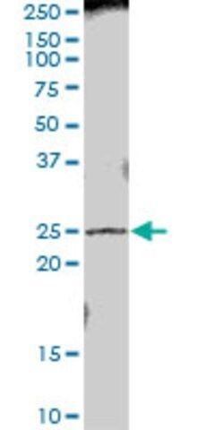 Anti-PRTFDC1 antibody produced in mouse