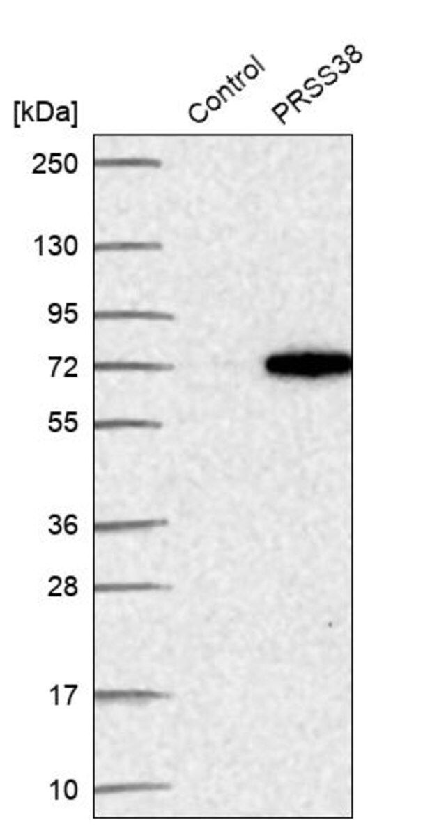 Anti-PRSS38 antibody produced in rabbit