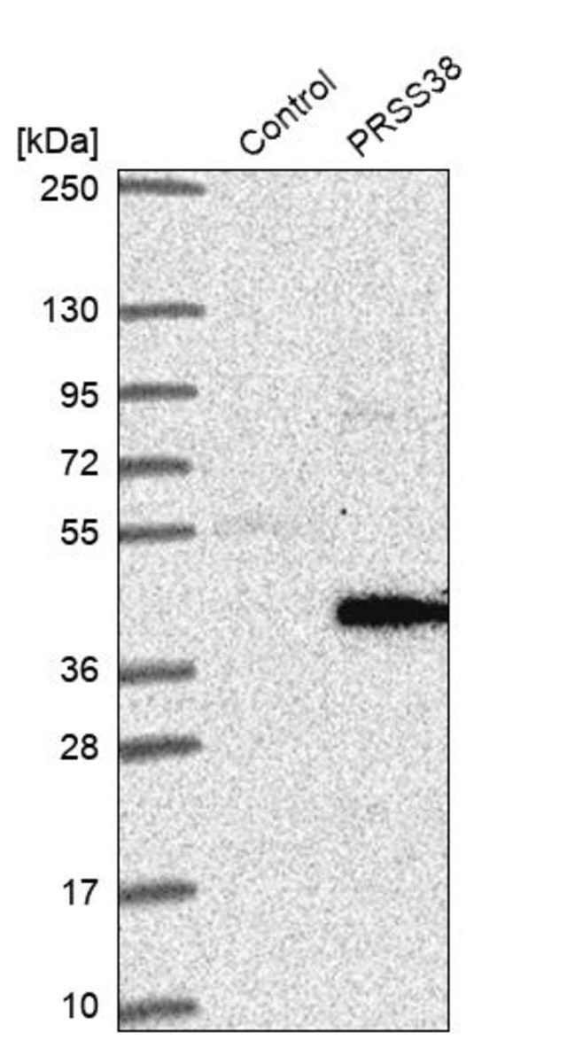 Anti-PRSS38 antibody produced in rabbit