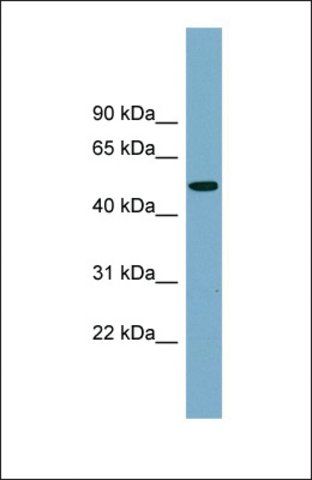 Anti-PRSS16 antibody produced in rabbit