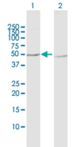 Anti-PPP2R2B antibody produced in rabbit