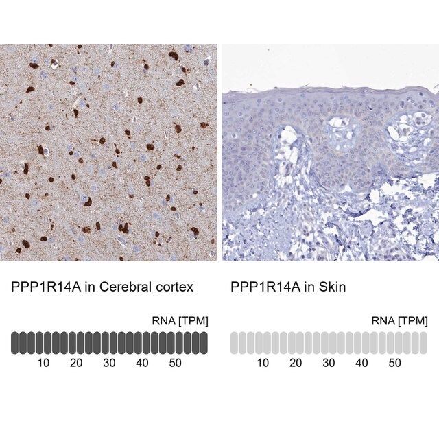 Anti-PPP1R14A antibody produced in rabbit