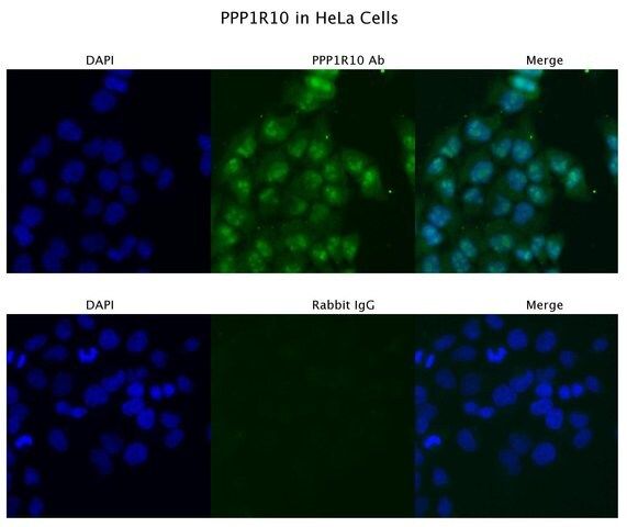 Anti-PPP1R10 antibody produced in rabbit