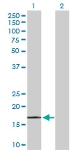 Anti-PPP1R14A antibody produced in rabbit