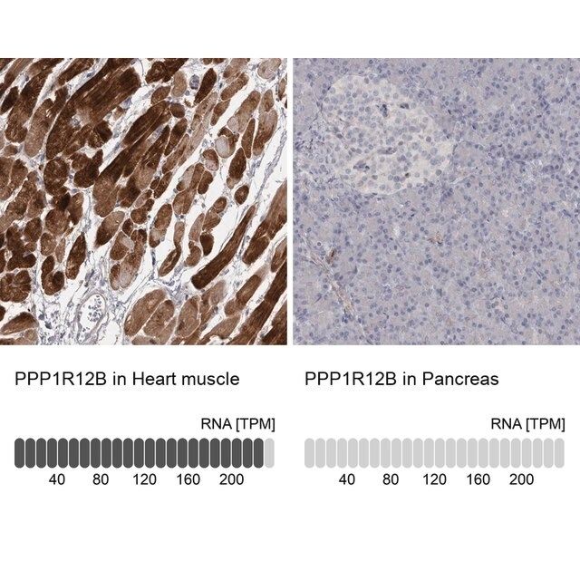 Anti-PPP1R12B antibody produced in rabbit