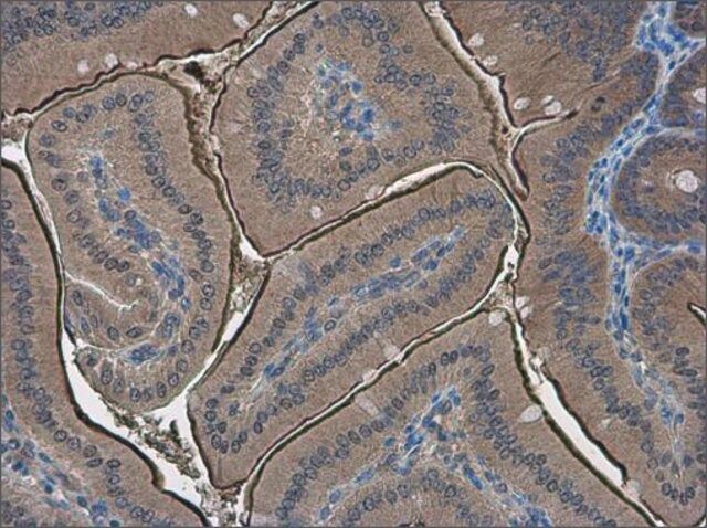 Anti-PPP2R2D antibody produced in rabbit