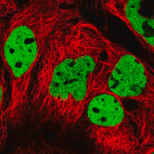 Anti-PPP1R14A antibody produced in rabbit