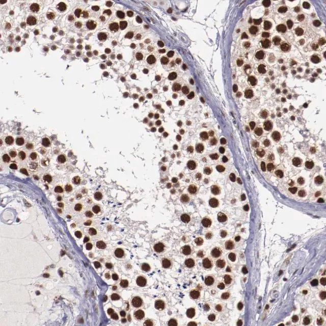 Anti-PPP4R3A antibody produced in rabbit