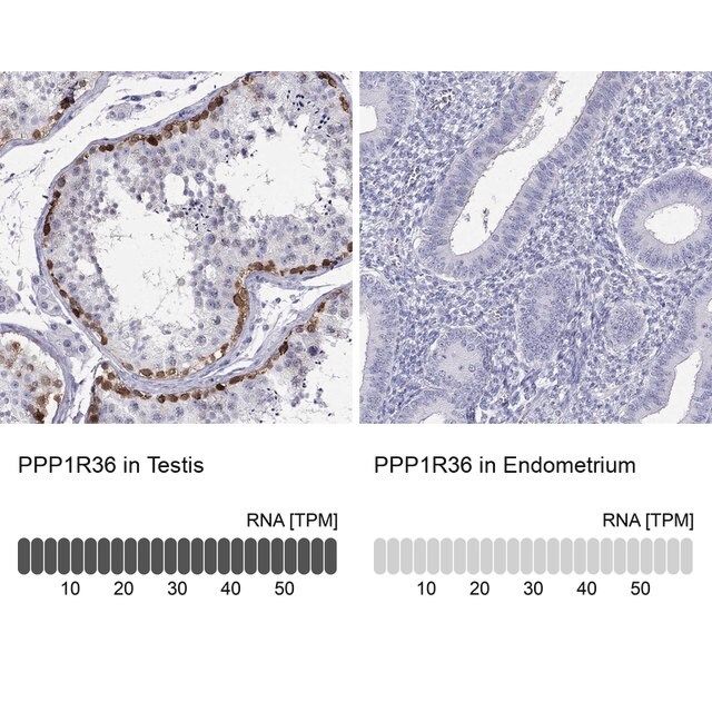 Anti-PPP1R36