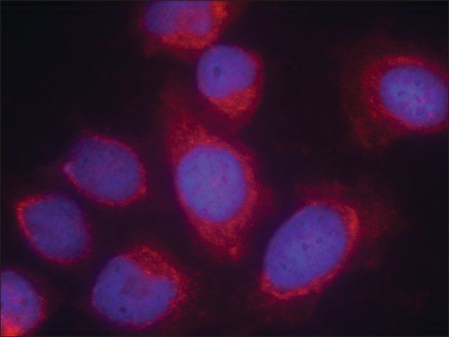 Anti-PPP1R14A (Ab-38) antibody produced in rabbit