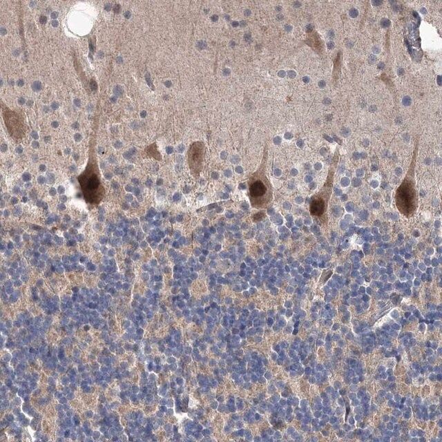 Anti-PPP2R2B antibody produced in rabbit