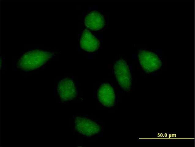 Anti-PPP1R13L antibody produced in mouse