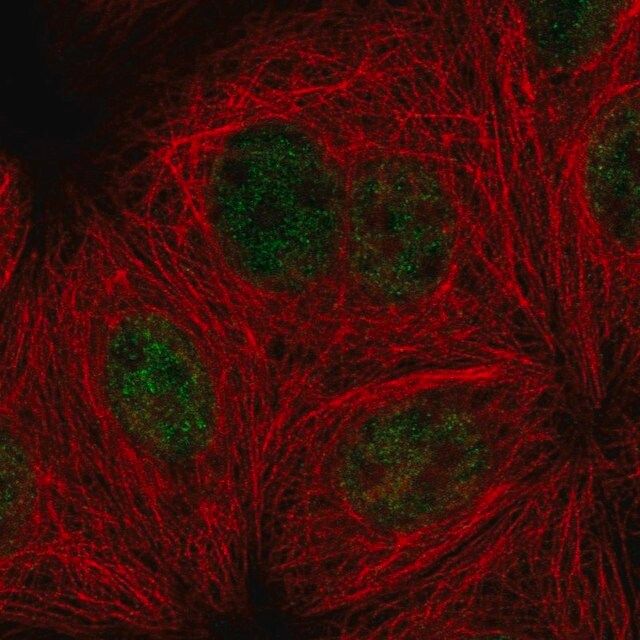 Anti-PPP4R3A antibody produced in rabbit