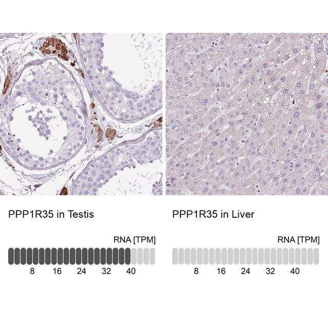 Anti-PPP1R35 antibody produced in rabbit