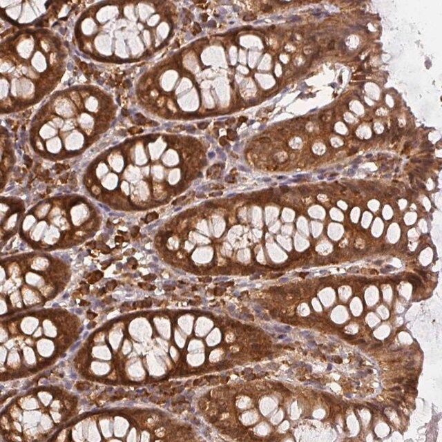 Anti-PPP6R3 antibody produced in rabbit