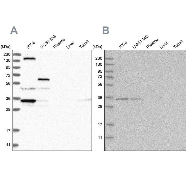 Anti-PPP1R42 antibody produced in rabbit