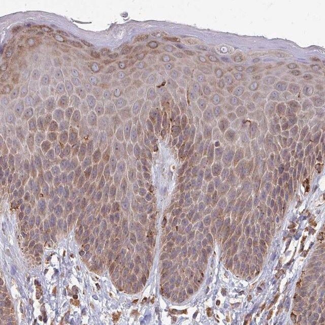 Anti-PPP1R13L antibody produced in rabbit