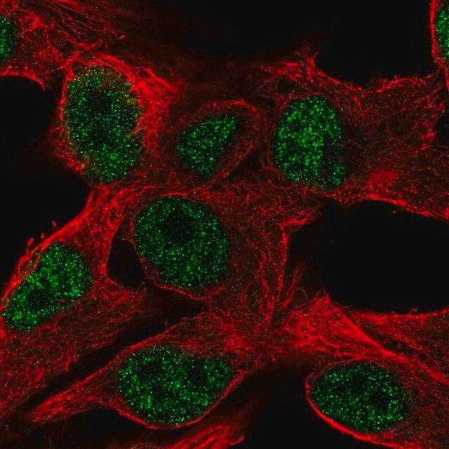 Anti-PPP1R35 antibody produced in rabbit