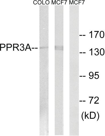 Anti-PPP1R3A antibody produced in rabbit